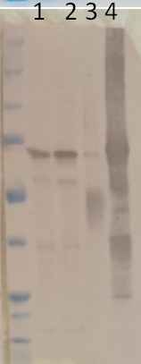 western blot using anti-PGM1 antibodies